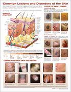 Common Lesions and Disorders of the Skin Anatomical Chart (en Inglés)