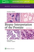 Biopsy Interpretation of the Prostate (en Inglés)