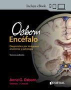 Osborn EncéFalo. DiagnóStico por ImáGenes, AnatomíA y PatologíA