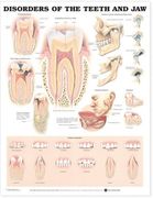 disorders of the teeth and jaw anatomical chart