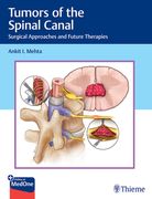 Tumors of the Spinal Canal: Surgical Approaches and Future Therapies (en Inglés)