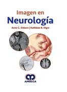 Imagen en Neurología