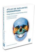 Atlas de Implantes Cigomáticos: Diagnóstico y Tratamiento Clínico