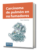 Carcinoma De Pulmon En No Fumadores