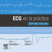Ecg en la Práctica