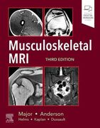 Musculoskeletal Mri, 3e 