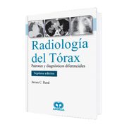 Radiología del Tórax. Patrones y Diagnósticos Diferenciales. 7ª Edición