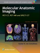 Molecular Anatomic Imaging: Pet/Ct, Pet/MR and Spect CT (en Inglés)