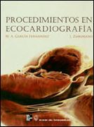 procedimientos en ecocardiografia