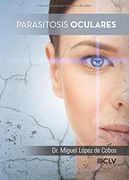 Parasitosis oculares