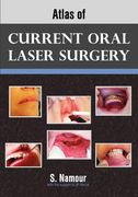 atlas of current oral laser surgery (en Inglés)