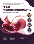 Fetal neurosonography (en Inglés)