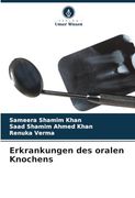 Erkrankungen des Oralen Knochens (en Alemán)