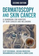 Dermatoscopy and Skin Cancer, Second Edition (en Inglés)