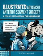 Illustrated Advanced Anterior Segment Surgery: A Step-By-Step Guide for Challenging Cases (en Inglés)