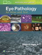 Eye Pathology: An Atlas and Text