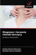 Diagnoza i leczenie chorób tarczycy (in Polaco)