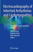 Electrocardiography of Inherited Arrhythmias and Cardiomyopathies: From Basic Science to Clinical Practice (en Inglés)