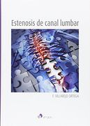 Estenosis de Canal Lumbar