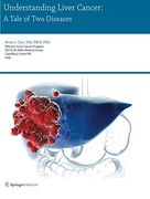 Understanding Liver Cancer: A Tale of two Diseases
