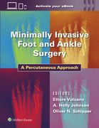 Minimally Invasive Foot and Ankle Surgery: A Percutaneous Approach (en Inglés)