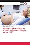 Hallazgos Prenatales de Acretismo Placentario por Ultrasonido