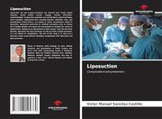 Liposuction (en Inglés)