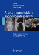 artrite reumatoide e spondiloentesoartriti (en Italiano)