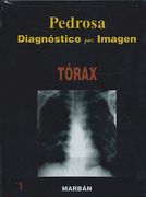 Diagnóstico por Imagen, Vol. 1: Tórax -gran formato- (in Spanish)