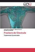 Fractura de Clavicula: Tratamiento Conservador