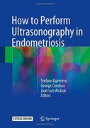 How to Perform Ultrasonography in Endometriosis (en Inglés)