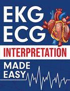 Ekg | ecg Interpretation Made Easy: An Illustrated Study Guide for Students to Easily Learn how to Read & Interpret ecg Strips (en Inglés)