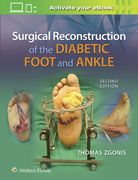 Surgical Reconstruction of the Diabetic Foot and Ankle (en Inglés)