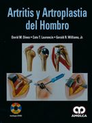 Artritis y Artrosplastia del Hombro