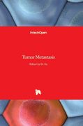 Tumor Metastasis (en Inglés)