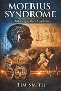 Moebius Syndrome: A History of a Rare Condition (en Inglés)