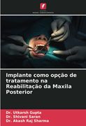 Implante Como Opção de Tratamento na Reabilitação da Maxila Posterior (en Portugués)