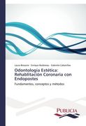 Odontologia Estetica: Rehablitacion Coronaria Con Endopostes