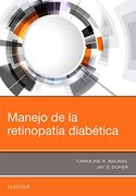 Manejo de la Retinopatía Diabética