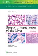 Biopsy Interpretation of the Liver (en Inglés)