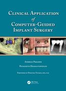Clinical Application of Computer-Guided Implant Surgery (en Inglés)