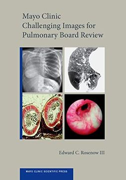 portada Mayo Clinic Challenging Images for Pulmonary Board Review (Mayo Clinic Scientific Press) (en Inglés)