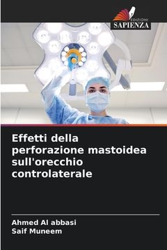 portada Effetti della perforazione mastoidea sull'orecchio controlaterale (en Italiano)