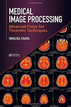 portada Medical Image Processing: Advanced Fuzzy Set Theoretic Techniques (en Inglés)
