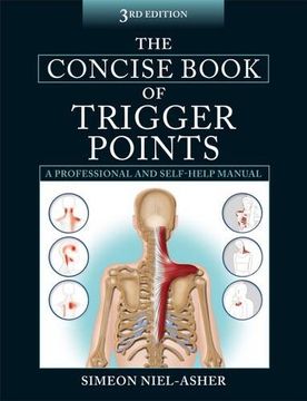 portada The Concise Book of Trigger Points
