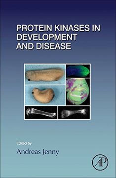 portada Protein Kinases in Development and Disease: Volume 123 (Current Topics in Developmental Biology) (en Inglés)