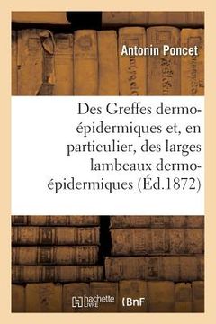 portada Des Greffes Dermo-Épidermiques Et, En Particulier, Des Larges Lambeaux Dermo-Épidermiques (in French)