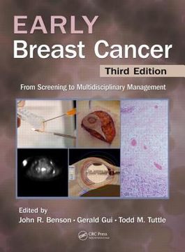 portada Early Breast Cancer: From Screening to Multidisciplinary Management, Third Edition (en Inglés)