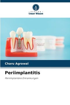 portada Periimplantitis (in German)