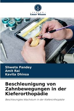 portada Beschleunigung von Zahnbewegungen in der Kieferorthopädie (en Alemán)
